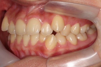 부산교정전문의