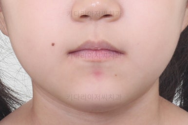 부산초등학생교정