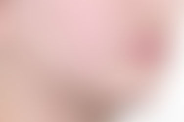 부산덧니교정