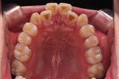부산인비절라인