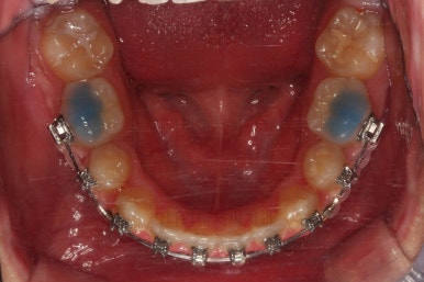 부산교정치과추천