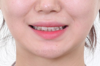 연산동교정치과