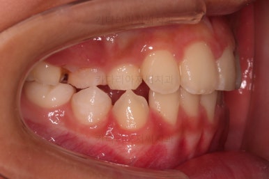 부산어린이교정