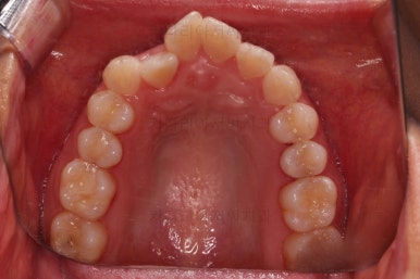 부산교정잘하는치과
