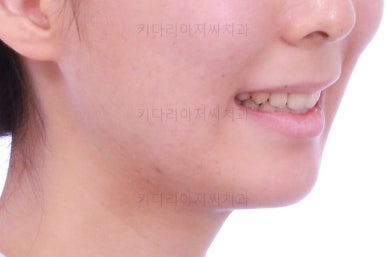 부산무턱교정치과