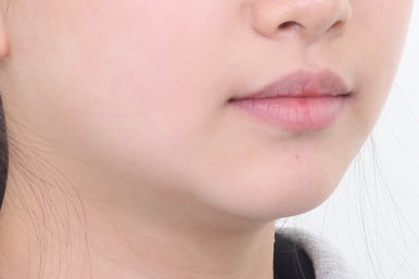 부산치아교정잘하는곳