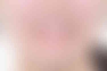 부산치아교정추천