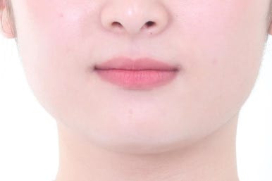 부산교정치과