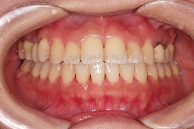 부산연산동치과