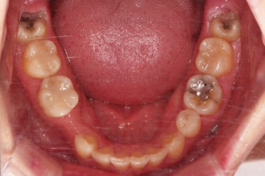 부산인비절라인