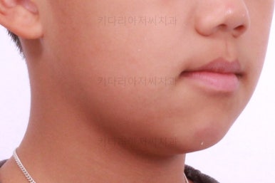 부산어린이교정