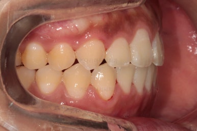 부산치아교정치과