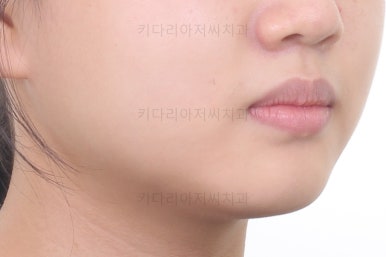 부산교정전문의