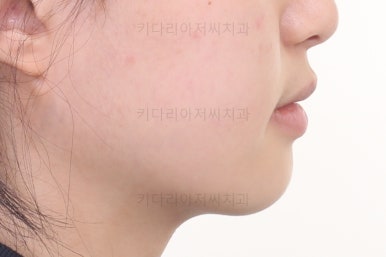 동래구치아교정