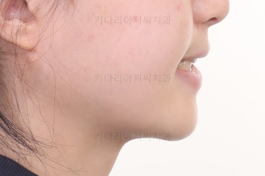 동래구치아교정