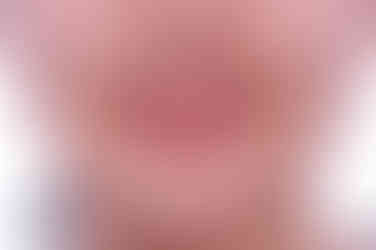 부산비발치교정