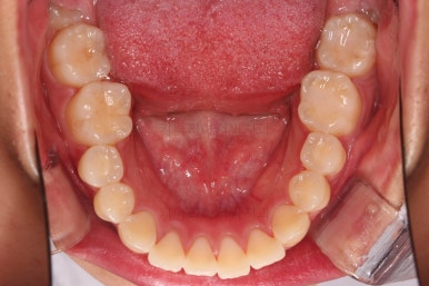 부산연산역치아교정