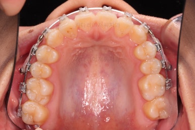 부산치아교정치과