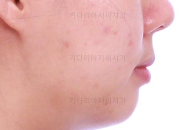 부산치아교정잘하는치과