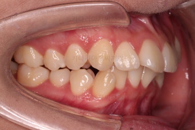 연산동치아교정치과