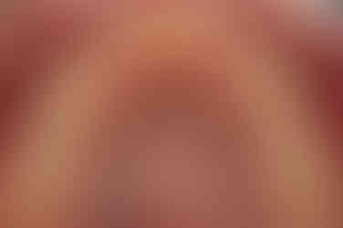 부산왜소치교정