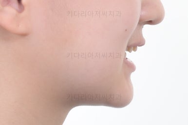 부산청소년교정치과