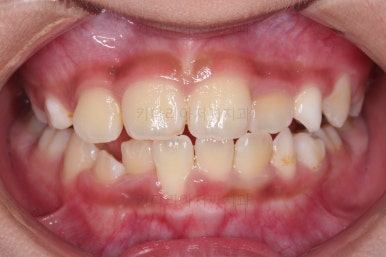 부산어린이교정