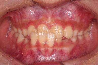 부산어린이교정