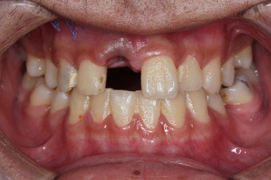 부산교정잘하는치과