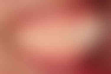 부산연산역치아교정