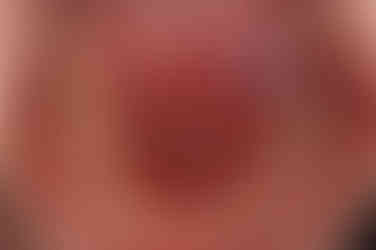 부산임플란트교정