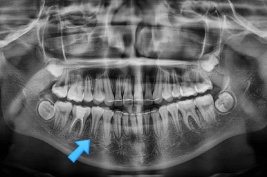 부산치아교정잘하는곳
