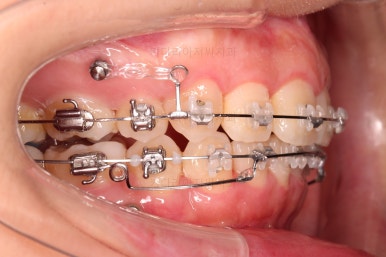 부산무턱교정치과
