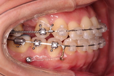 부산연산동치과