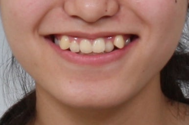 부산교정전문의