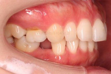 부산인비절라인