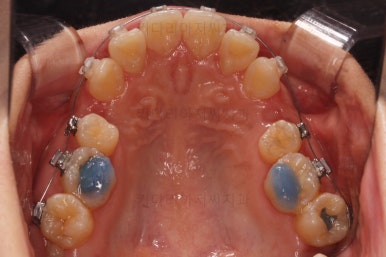 부산무턱교정치과