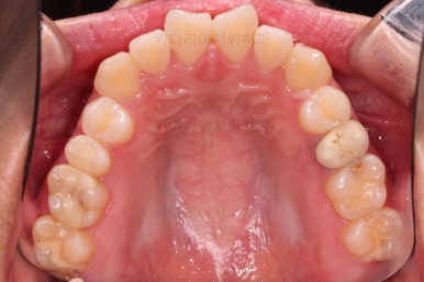 부산치아교정잘하는곳