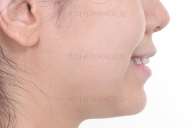 부산교정잘하는치과