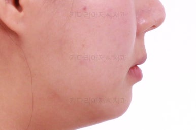 부산치아교정잘하는치과