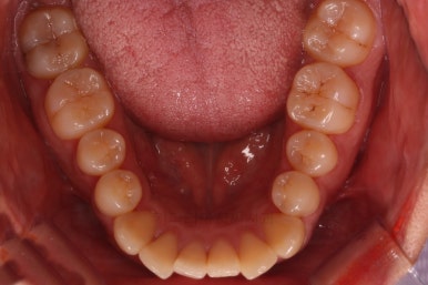 연산동교정치과