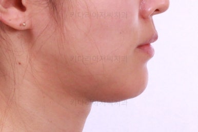 부산치아교정잘하는곳