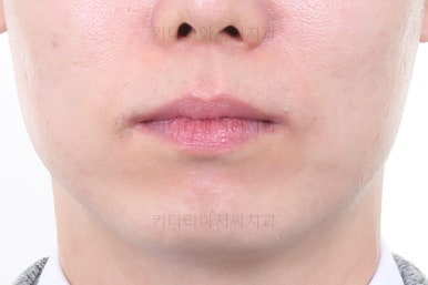 부산교정치과
