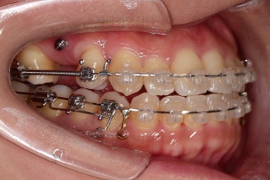 부산연산동치과