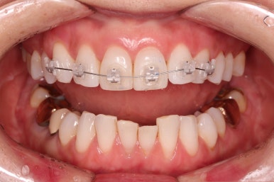 연산동부분교정