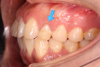 연산동교정치과