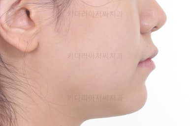 부산교정잘하는치과
