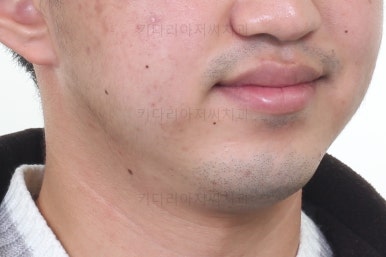 연산동교정전문치과