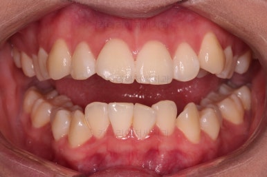 연산동치아교정치과