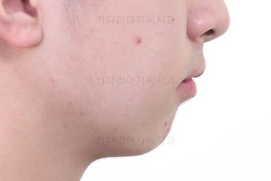 부산교정치과추천